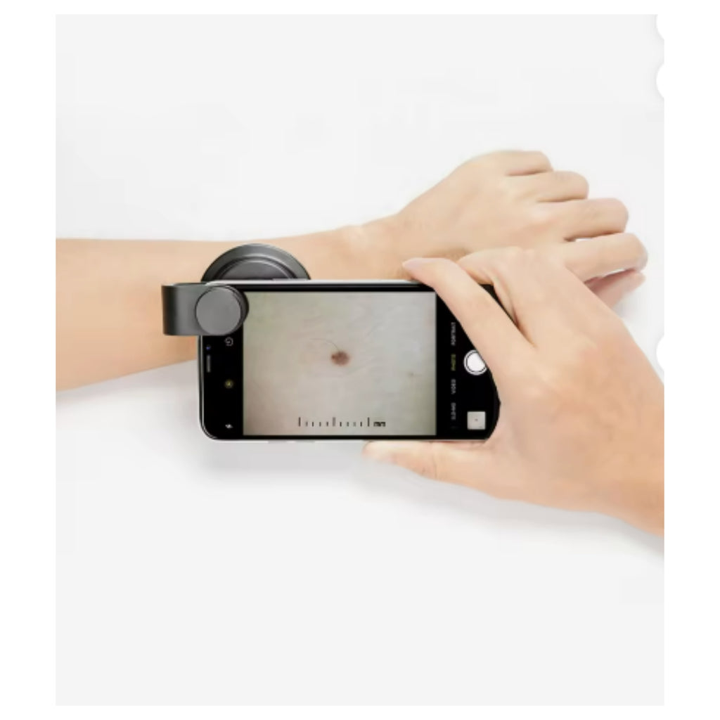 10X Electric Magnifying Camera Dermatoscope for Scalp and Hair Loss Detection - Polarized